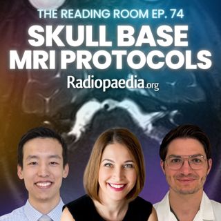 74. Skull base MRI protocols