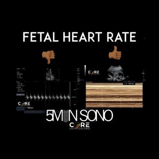 Fetal Heart Rate Assessment using POCUS! (5MS)