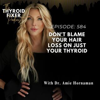 584. Don't Blame Your Hair Loss on JUST Your Thyroid