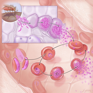 Diagnosis, Treatment, and Prevention of Malaria in the US