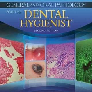 General and Oral Pathology for the Dental Hygienist