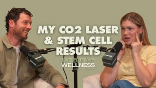 My C02 Laser Experience: Dr. Cameron Chesnut Part 2