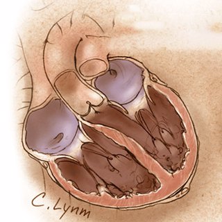 Management of Heart Failure in 2019-2020, Part 2