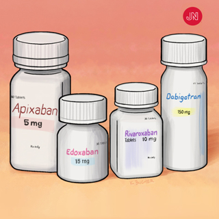 Review of Atrial Fibrillation Treatment