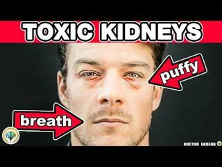 10 Signs Your Kidneys Are Toxic