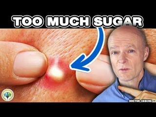 10 Signs You're Eating Too Much Sugar