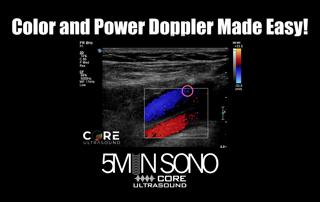 Color and Power Doppler Made Easy!