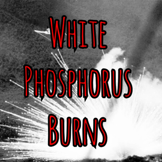 Prolonged Field Care Podcast: White Phosphorus Burns