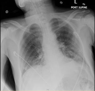 Podcast 560: Imaging in a COVID world