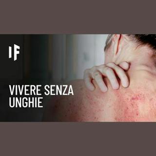 E se gli esseri umani non avessero le unghie?