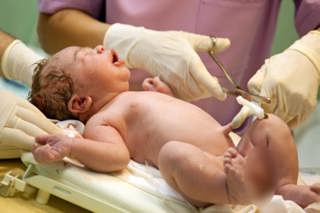 The Natural Cesarean