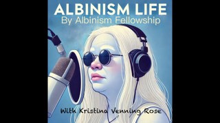 Albinism Life growing up in Nigeria as a black person with albinism 