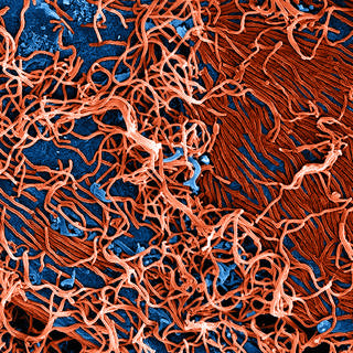 TWiV 341: Ebolavirus experiences