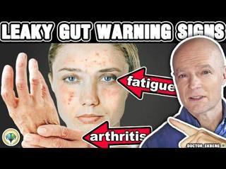 10 Signs That You Have A Leaky Gut 