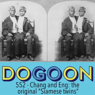 552 - Chang and Eng, the original "Siamese twins"