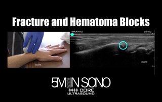 Find that fracture in seconds (and with no radiation!) AND perform that hematoma block with precision accuracy with POCUS