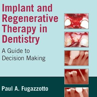 Implant and Regenerative Therapy in Dentistry: A Guide to Decision Making