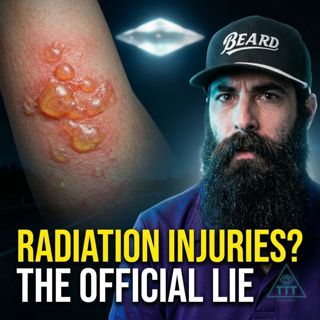 The Cash-Landrum Incident – Physical Evidence the Government Can't Explain