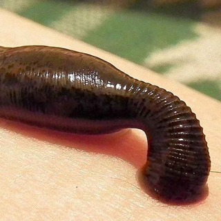 Everything You Need To Know About Leeches