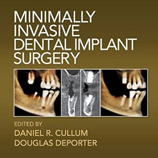Minimally Invasive Dental Implant Surgery