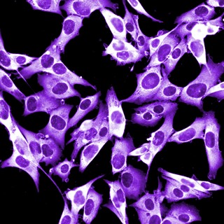 Melanoma up Close