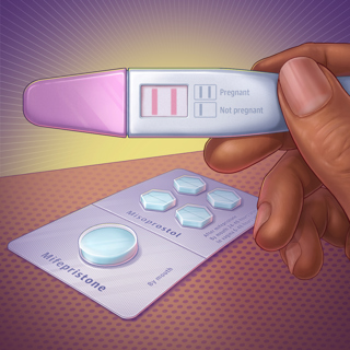 Medication Abortion Using Mifepristone and Misoprostol