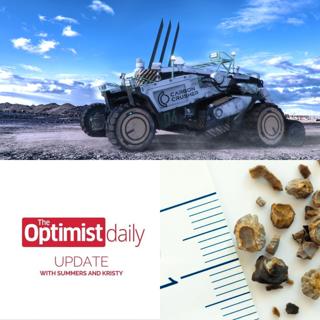 The Carbon Crusher & Crushing Kidney Stones