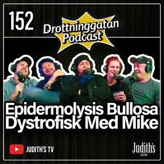 152. Epidermolysis Bullosa Dystrofisk Med Mike