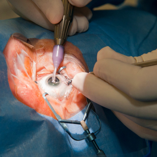 Association of Opioids With Incisional Ocular Surgery
