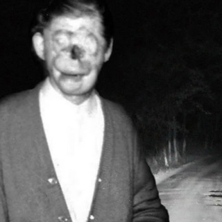 Urban Legends That Turned Out To Be True: Charlie No-Face (PODCAST EXCLUSIVE)