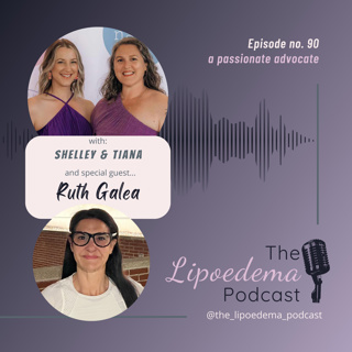 Ep. 90 ~ Lipoedema Warrior Ruth Galea