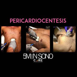 5 Minute Sono - Pericardiocentesis