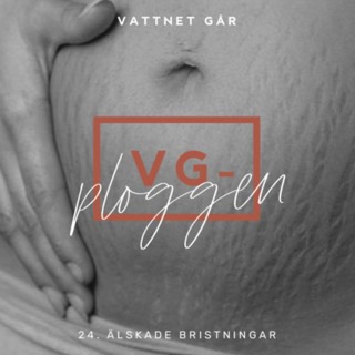 633. VG-ploggen - Vad är havandeskapsförgiftning?