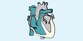28. Coronary Artery Bypass Grafting