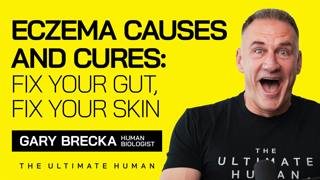 176. Why Your Eczema Isn’t Just Skin Deep...Here’s the REAL Cause!