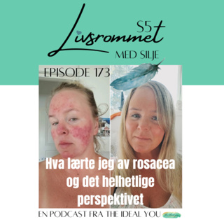 E173: Hva lærte jeg av rosacea og det helhetlige perspektivet