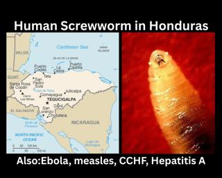 Human Screwworm in Honduras, Ebola update, measles in Bangladesh and Guatemala, Manitoba Hepatitis A