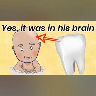How a Tooth Was Found Inside a Boy's Brain
