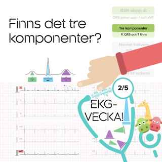 02 Finns det tre komponenter?