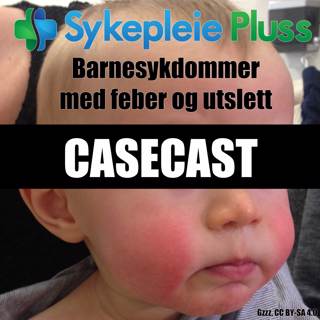 Case - Barnesykdom med feber og utslett