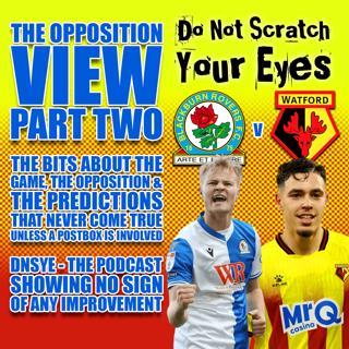 OPPOSITION VIEW PART 2 : BLACKBURN ROVERS AWAY