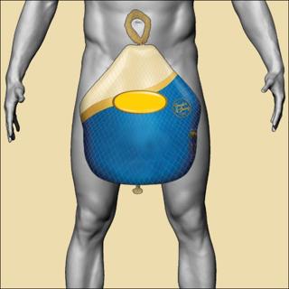 Episode 449: Butterballs