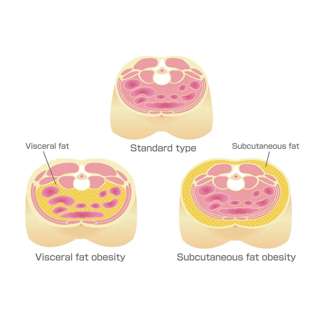 Visceral Adipose Tissue (VAT) as a Major Modifiable Driver of Cardiometabolic Risk