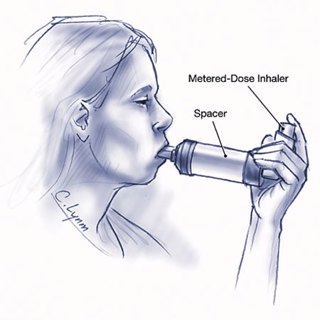 How to Diagnose and Manage Adult Asthma