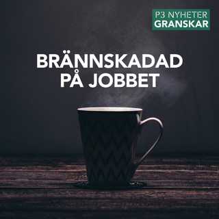 Brännskadad på jobbet - P3 Nyheter Granskar