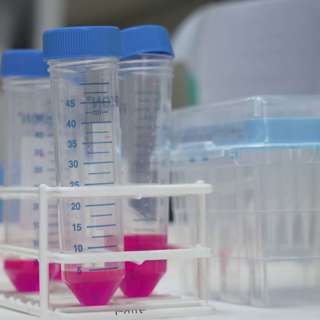 UK Economy Grows 0.5% in February, NHS Approves Capivasertib for Cancer, 92-Year-Old Slams Compensation Insufficiency, University of Sussex Fined for Free Speech, and more...