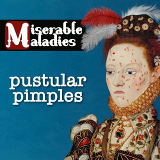 Tudor Time Machines's Miserable Maladies: Pimples