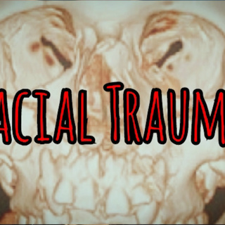 Facial Trauma