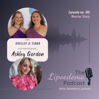Ep. 105 ~ Lipoedema Warrior Ashley Gordon