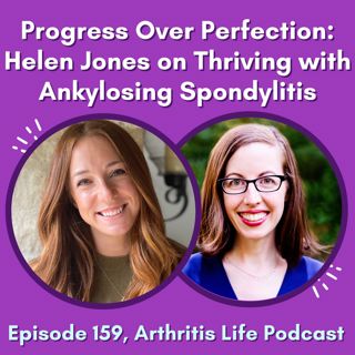 Progress Over Perfection: Helen Jones on Thriving with Ankylosing Spondylitis